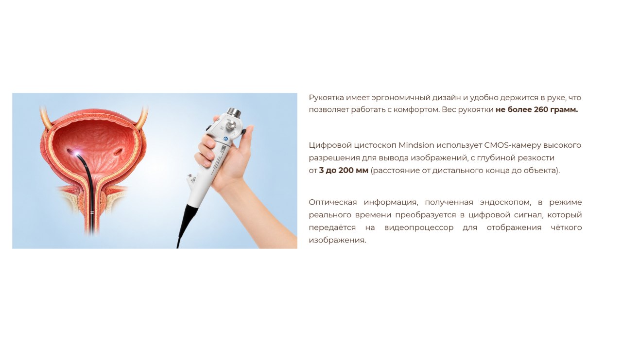 Применение видеоцистоскопа Mindsion в урологии
